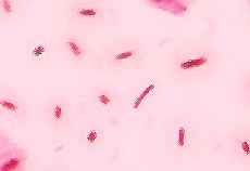 stikstofbindende bacterie Azotobacter